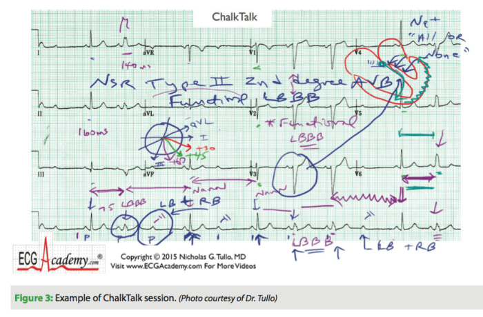 Ecg academy level 2 final exam answers