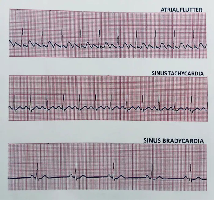 Ecg academy level 2 final exam answers